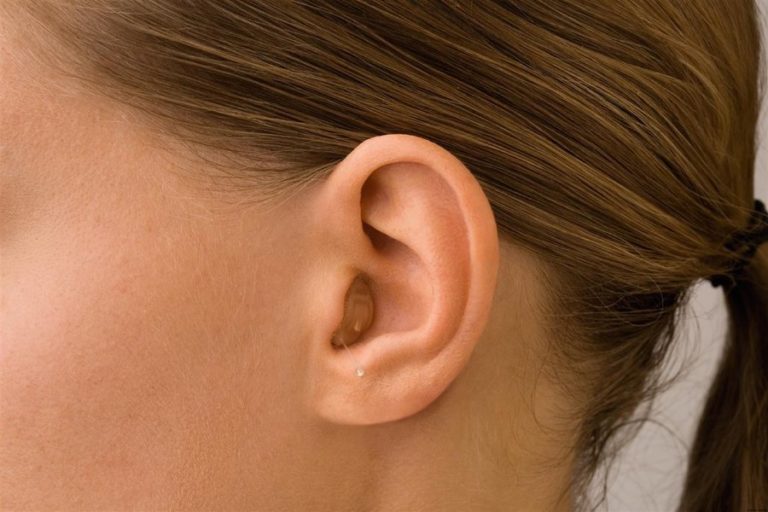 Внутриушные слуховые аппараты: критерии выбора, преимущества моделей