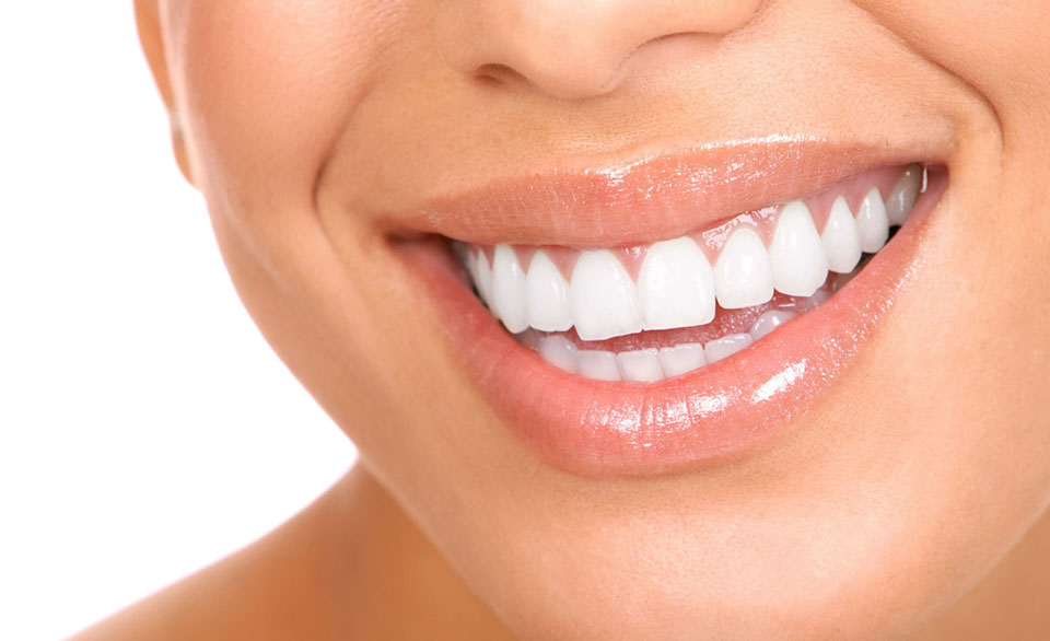 Хотите белоснежную улыбку? Отбеливающие полоски для зубов помогут Вам завораживающе улыбаться