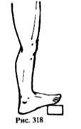 Упражнения для развития мышц голени и стопы